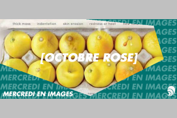[OCTROSE] [EN IMAGES] "Know Your Lemons" pour sensibiliser au cancer du sein