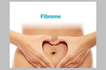 Fibrome utérin: halte à la banalisation!